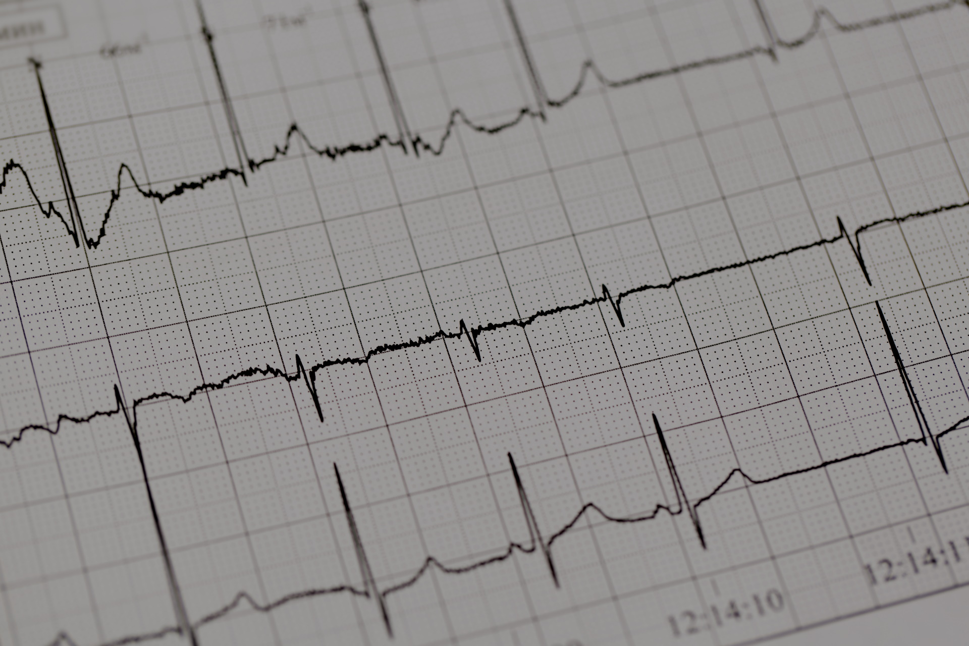 AED gebruiken bij iemand met een pacemaker
